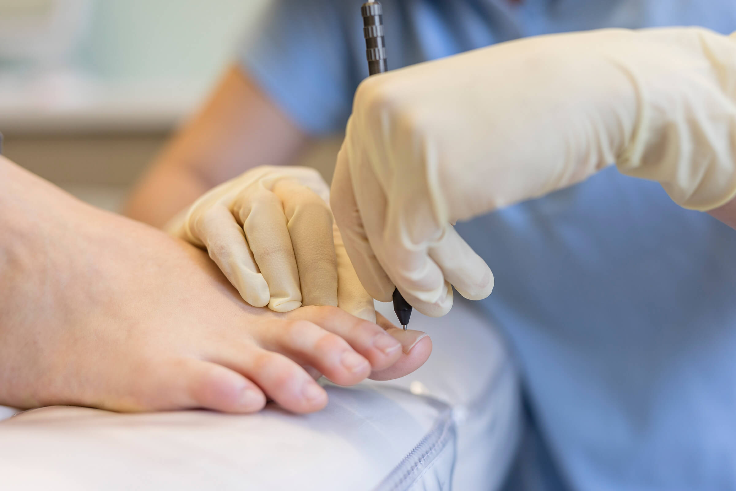Med. Fußpflege Nagelbehandlung - Hautarztpraxis Dr. Zorn in Kronberg