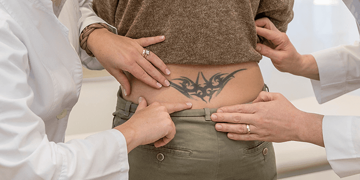Tattoo Entfernung durch Laser in der Hautarztpraxis Kronberg bei Oberursel